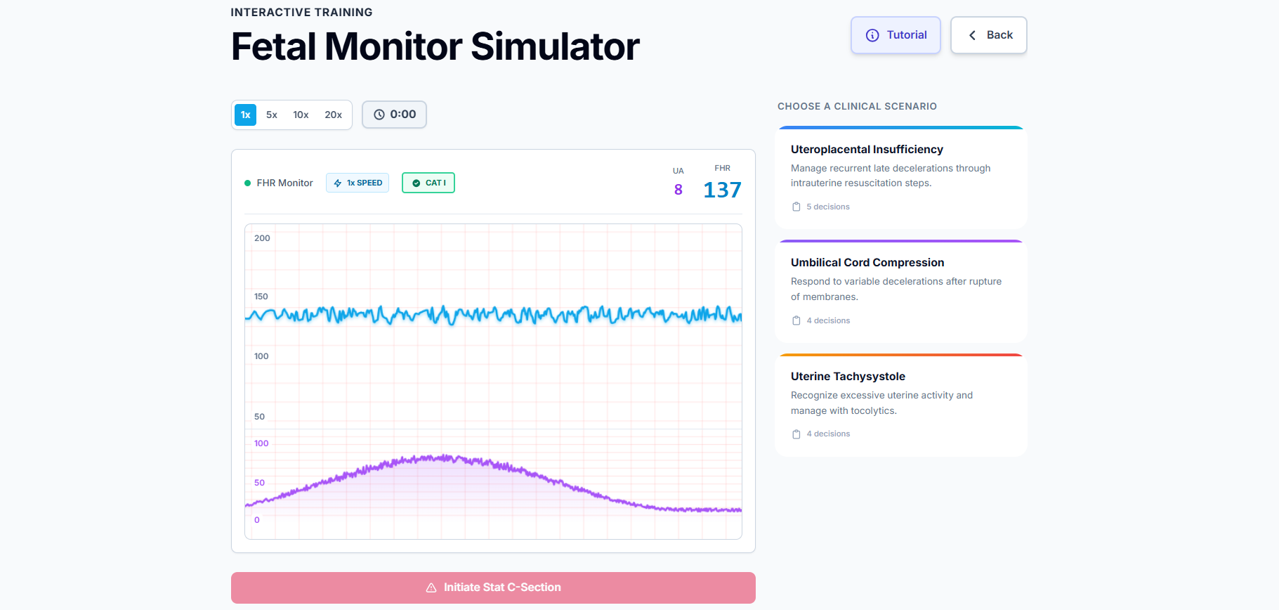 OB Fetal Monitor simulation screen 1